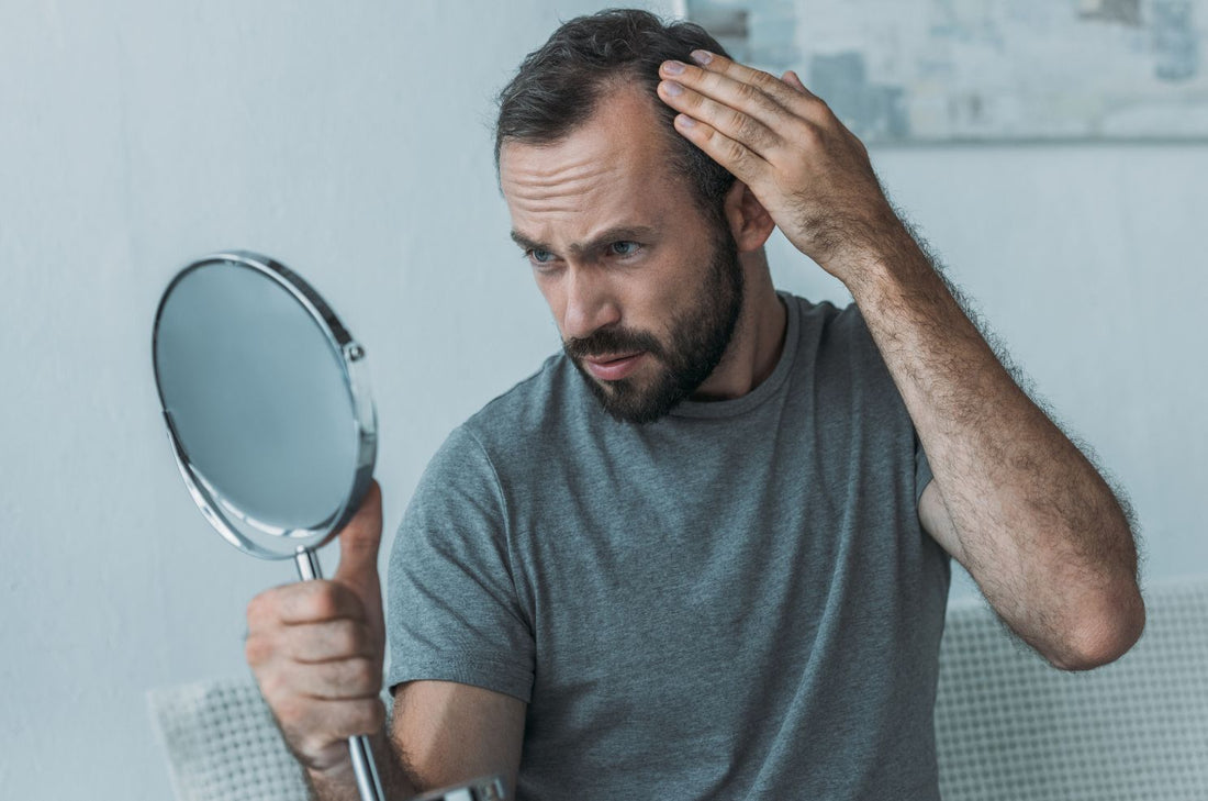 Knowing Your Bald Spot Treatment Options