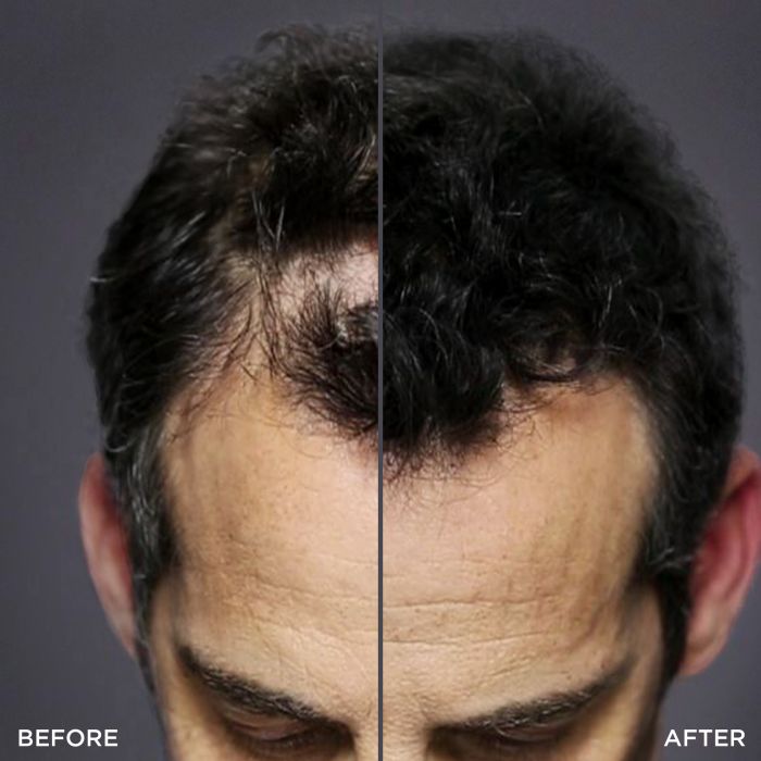 Top view of man's Head Showing before and after using Toppik hair building fibers