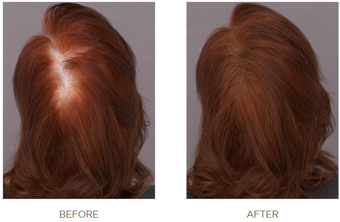 Top view of a woman’s head before and after using Toppik Hair Fibers, showing visibly fuller-looking hair.