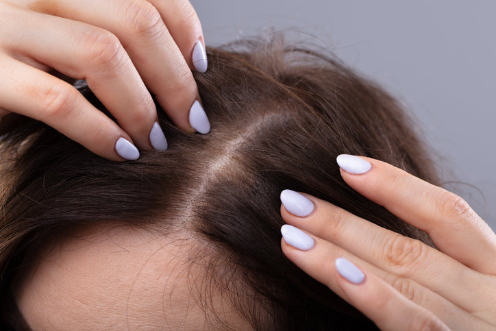 Scalp microblading is an option for men and women with thinning hair.