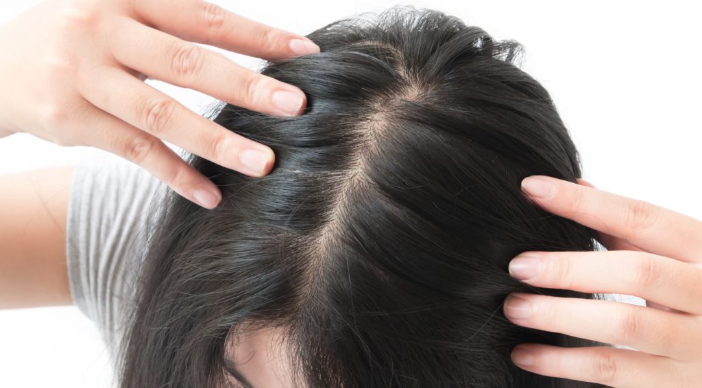woman with black hair showing hair part knowing your bald spot treatment options toppik hair blog