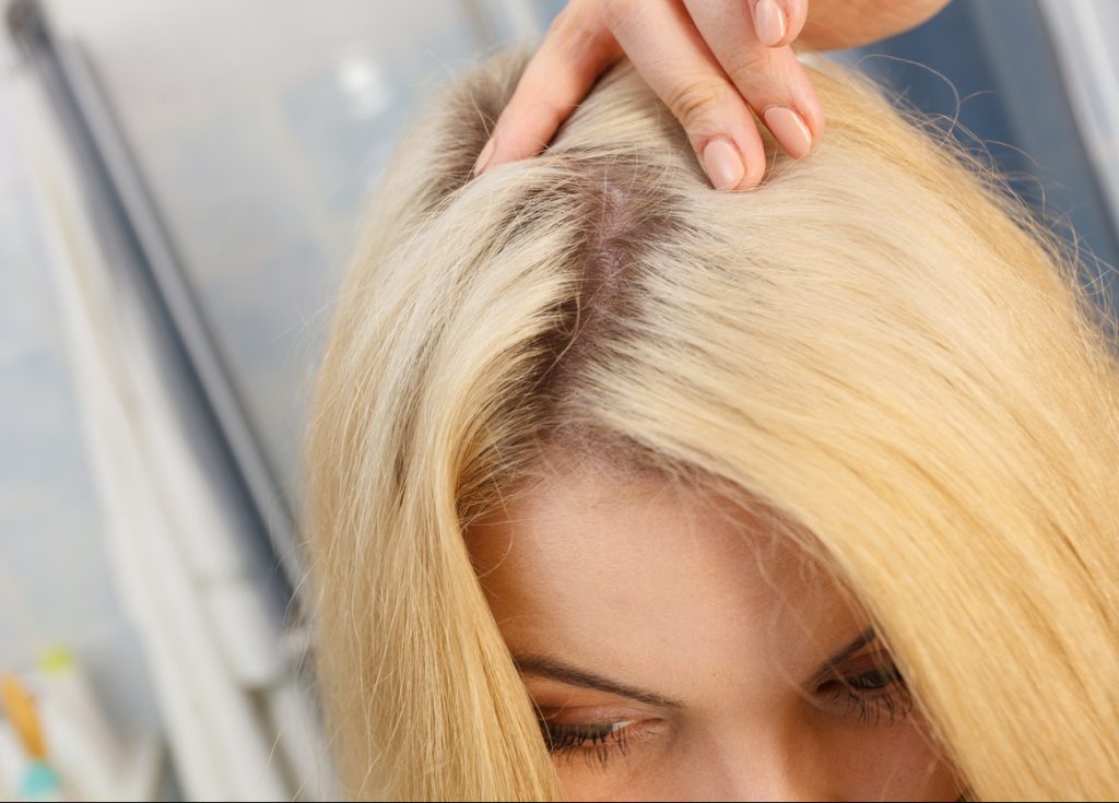hair part dark roots blonde woman avoiding bleach damaged hair toppik hair blog