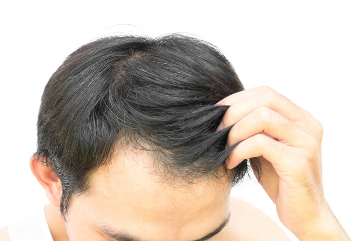 Men head thinning crown