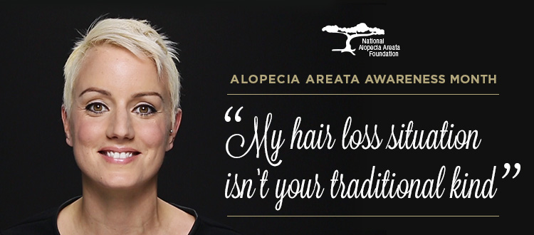A Good Cause: Raising Awareness for Alopecia Areata