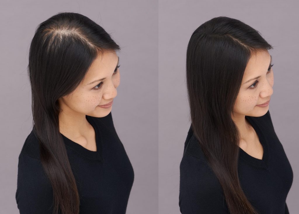 Toppik Fibers before and after photos woman Hazel black hair why is my hair thinning at the part toppik hair blog