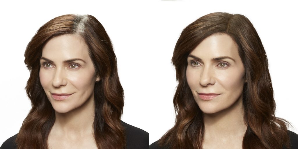 Before and after photos of woman with part clearly showing missing hair and fuller hair on the right (due to Toppik Root Touch-Up)