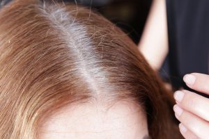 red hair with gray roots the best root touchup spray Toppik hair blog