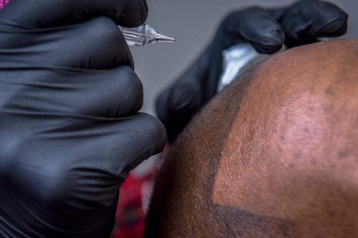scalp microblading