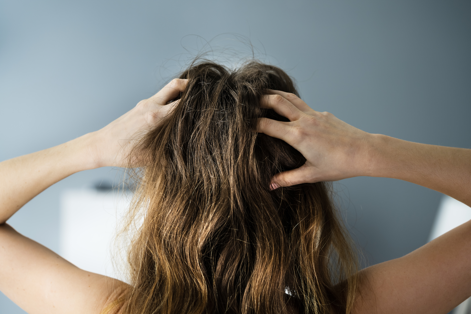 Dry Hair Causes, Symptoms and Treatments - Toppik Blog
